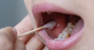 口腔棉签提取方法