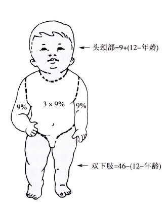儿童体表面积估计